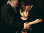 two parents cradle their child who has had a face transplant