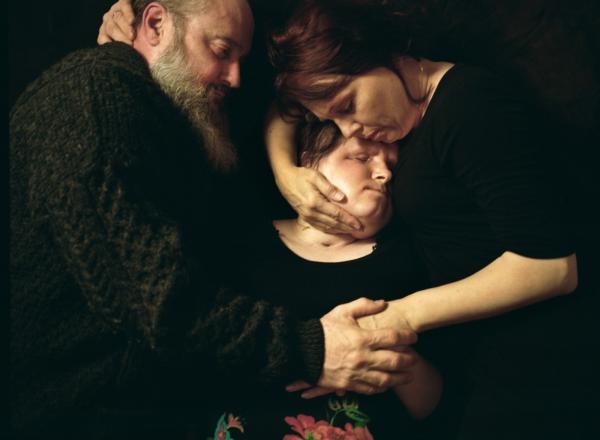 two parents cradle their child who has had a face transplant