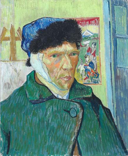 Van Gogh in a green jacket and hat, with a bandage wrapped around the side of his face and under his chin. 